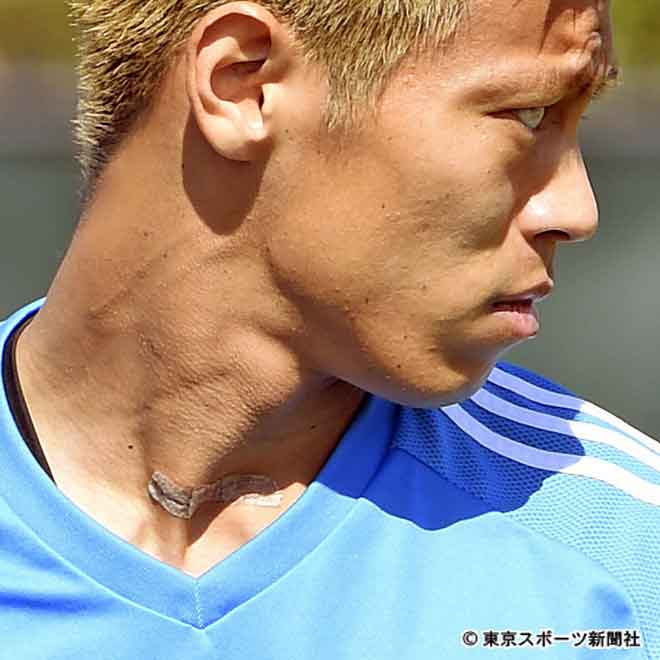 本田圭佑 バセドウ病で不調 放射能の影響も 人気トレンドニュース速報ブログ